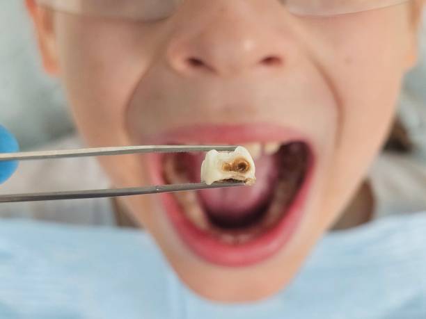 Best Emergency Dental Services for Seniors in Glenwood, AR