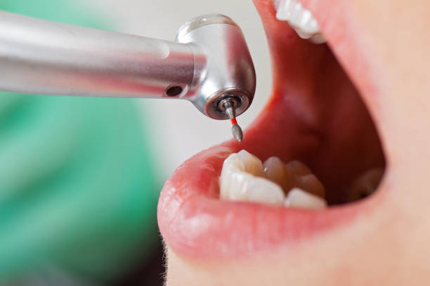 Best Emergency Dental Care for Abscessed Tooth in Glenwood, AR